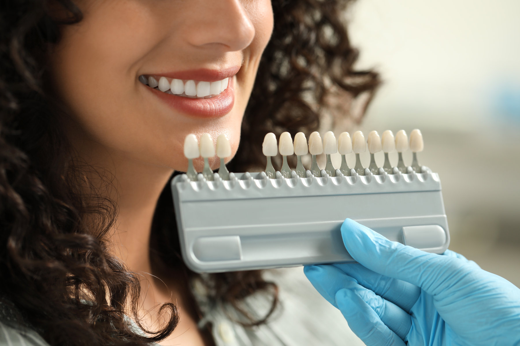 Doctor checking young woman’s teeth color in clinic, closeup. Dental veneers Doctor checking young woman's teeth color in clinic, closeup. Dental veneers